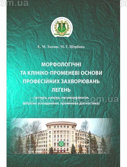 Морфологічні та клініко-променеві основи професійних захворювань легень (історія, клініка, патоморфологія, фіброзні ускладнення, променева діагностика) : Монографії - Видавництво "Право"