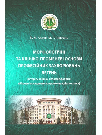 Морфологічні та клініко-променеві основи професійних захворювань легень (історія, клініка, патоморфологія, фіброзні ускладнення, променева діагностика)